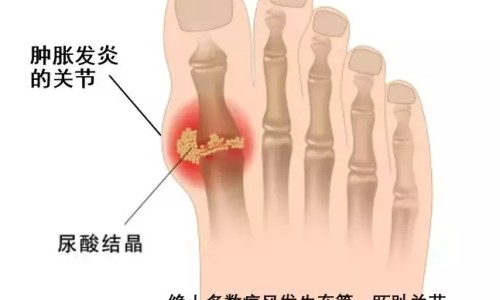 宫颈炎症吃中药管用吗-宫颈炎吃中药能好吗网 | 宫颈炎吃中药能好吗会复发吗,宫颈炎吃哪种药效果好