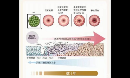 宫颈炎吃中药能好吗-宫颈炎吃中药能好吗网 | 宫颈炎吃中药能好吗会复发吗,宫颈炎吃哪种药效果好